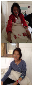 sister deng before and after2